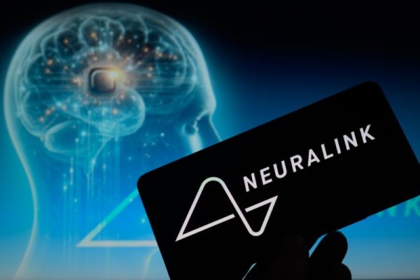 Neuralink s layout and opening results are striving to earn USD 1 billion in 2031